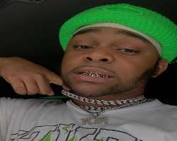 He has gold platted his teeth and also wear a thick chain in his neck He has gold platted his teeth and also wear a thick chain in his neck.